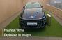 2026 Hyundai Verna Facelift: Check Out The Popular Sedan In Our DETAILED Image Gallery 2026 Hyundai Verna Facelift: Check Out The Popular Sedan In Our DETAILED Image Gallery